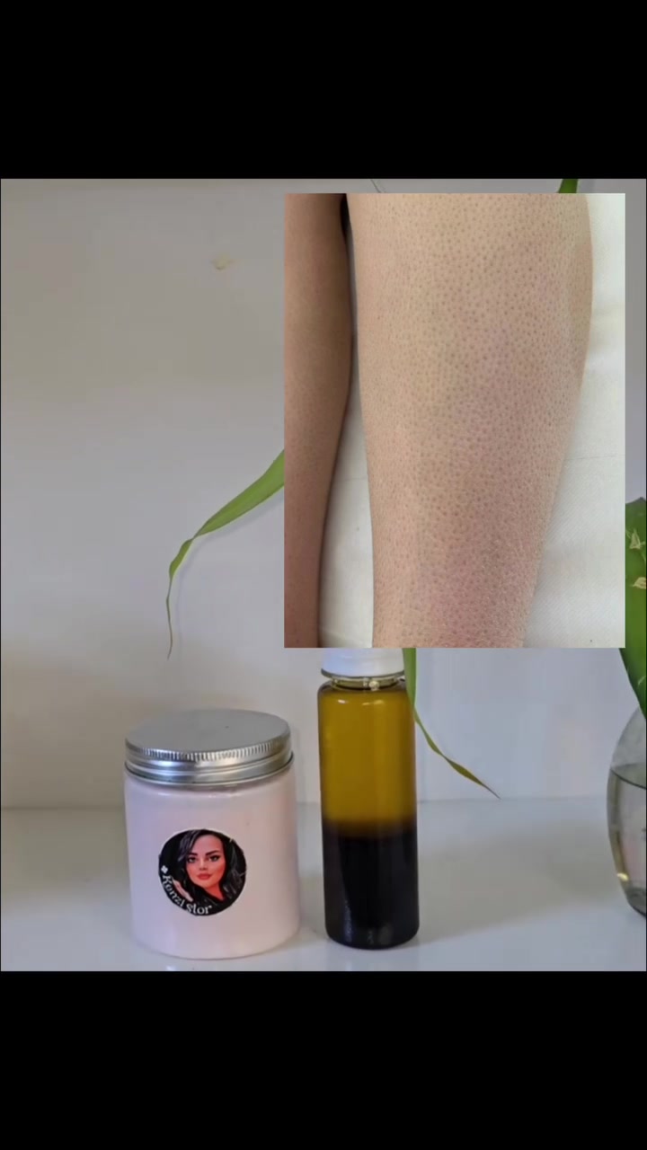 "مو بس يشيل الشعر… يخليه يختفي بالتدريج 😳✨
زيت السعد وكريم بديل الليزر الحل الي يخلي جسمج أنعم لفترة أطول!"

●يعمل على أضعاف البصيلات 
●يعمل على ابطاء نمو الشعر 
●يعتبر مرطب عميق للجسم 
●يحارب جلد الوزة 
●يهدء البشره من الالتهابات والتهيج 
●حتى المراكز بعد ميكملون جلساتج ينصحوج بزيت السعد لان ميخلي الشعر ينبت من جديد

#اكسبلور_explore #بسمايا
#منتجات_طبيعية


**إذا كنت صاحب هذا الإعلان وتريد حذفه لأي سبب، رجاءا أرسل رسالة إلى الدعم الفني**