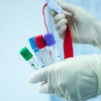 🔬 هرمونات الدورة الشهرية… مفتاح صحة المرأة تلعب هرمونات الدورة الشهرية...