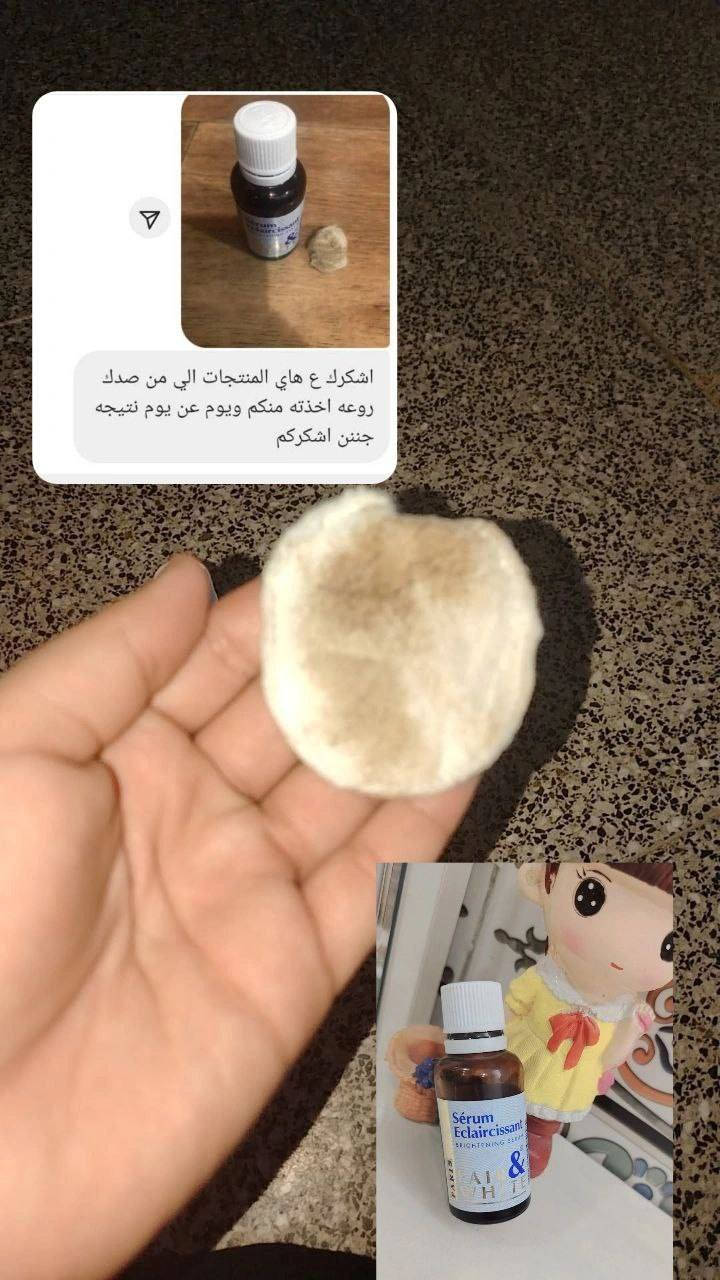 الاصلي وبس يمنه انتبهوا على تفاصيل علبة السيروم الفرنسي 🇫🇷 اليوم عرضنا للعرايس والمتزوجات سيروم  العناية بالمناطق الحساسه وبالجسم كامل
سيروم فير اند وايت الاصـلي 💯
الفرنسي 🇨🇵🇨🇵
سيروم مبيض مناطق حساسة 
منتج  عجيب يعمل على ::_
☆ تبييض المناطق الحساسة والداكنة بالجسم🤩
☆ يوحد لون البشـرة 
☆يعمل على تقشـير البشرة  ويرطب البشرة لان مكوناتة  زيوت طبيعية ترطب بشكل قوي
▪منتج يستخدم لأي منطقة حابين تبيضوها بالجسم☺ نتائجة رهيبة بالاستخدام المستمر تبين أكثـررر

هذا المنتج  جدا فعال 100% 🤗💪
خالي من العطور حتى لا يسبب اي حساسية

#للحجز_مراسله_الصفحه ✨✨✨✨


**إذا كنت صاحب هذا الإعلان وتريد حذفه لأي سبب، رجاءا أرسل رسالة إلى الدعم الفني**