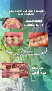 العلاج مجاني _العنوان جامعة الفراهيدي صعدة جسر الجادرية للتواصل واتساب...