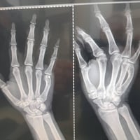 عيادة التقوى • فحص أشعة • الرمادي ٥كيلو