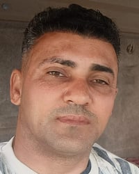 زراعة الشعر • مراحل الانبات • ٣-٤ أشهر