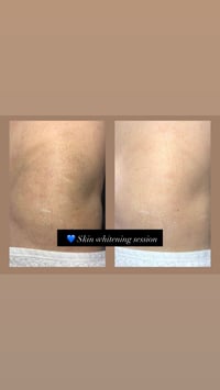 عيادة العناية المتكاملة ⚕️ ⚠️ صحتكِ أولاً: قبل أي إجراء، نقدم لكِ فحصا...