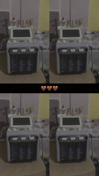 جهاز 💆‍♀️ جهاز تنظيف البشرة العميق 💆‍♀️  الرؤوس السوداء والمسام الواسع...