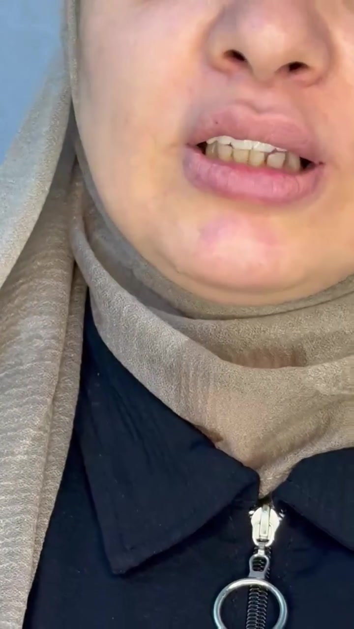 أراء المراجعين ترافقنا وياكم 
وجودهم غايتنا للوصول إلى التمييز 
لاتنسوا تابعونا ودعمونا بلايك وشير حتى يصلكم جديدنا

(ننوه عدم تفاعلكم على الصفحة لن تظهر لكم منشوراتنا الجديدة ولا عروضنا)

#تنظيف_أسنان
#معالجة_للثوية
#علاج_تسوس_الاسنان
#قلع_وتركيب_أسنان

مركز سما طويريج التخصصي
لطب وجراحه الفم والاسنان

•••••••••••••••••••••••••••••••••••••••••••••

العنوان 🏭  كربلاء _ قضاء الهندية _الشارع العام_مجاور نقابة المعلمين _ مقابل المكتبة العامة
الهاتف 📱***********
••••••••••••••••••••••••••••••••••••••••••••••

#مركز_طويريج تنظيف_الاسنان تبييض_ليزري تنظيف_منزلي حشوة تقويم اسنان

