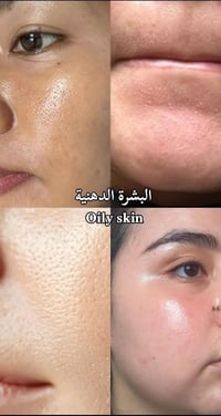 بشرة دهنية • روتين يومي • اكسلبور