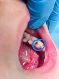 الي عنده اطفال عدهم مثل هيج حالة يتواصل وياي العلاج مجاناً واتساب على ...