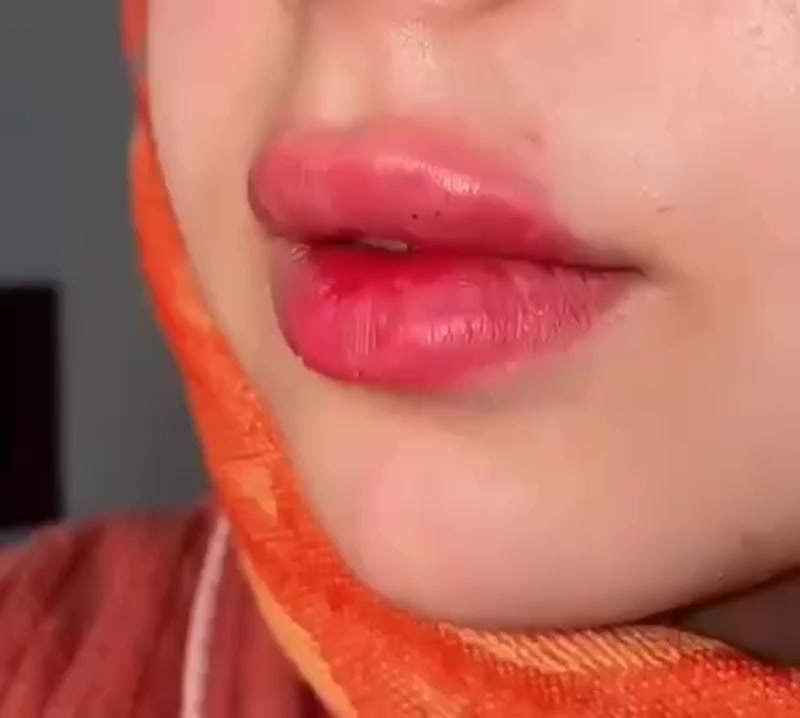 جمال الرسمه❤️🔥🥰
استغلوا عروض العيد ❤️❤️
مسوين خصم على قسم التجميل اللاجراحي 
حله /حي الامام


**إذا كنت صاحب هذا الإعلان وتريد حذفه لأي سبب، رجاءا أرسل رسالة إلى الدعم الفني**