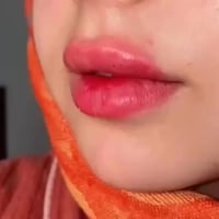 حله حي الامام • عروض العيد • تجميل لاجراحي