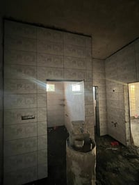 تركيب بورسلين • ضبط بالليزر • قضاء حديثه