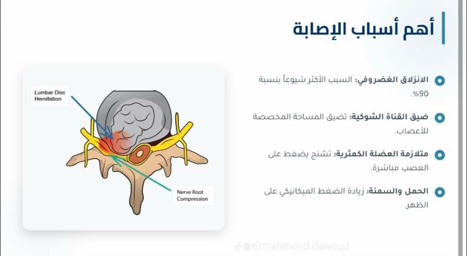 � تعلن عيادة الكوثر للعلاج الطبيعي والحجامة عن عروض مميزة 🌿

هل تعاني من:
✅ آلام الظهر والرقبة
✅ الانزلاق الغضروفي
✅ آلام المفاصل والركب
✅ الشد العضلي والتشنجات
✅ آلام الكتف والرقبة
✅ الإرهاق والتعب العام

نوفر لكم:
🔹 جلسات العلاج الطبيعي بأحدث الطرق
🔹 الحجامة العلاجية والوقائية
🔹 الإبر الصينية
🔹 كادر متخصص وخدمة مميزة
✅ يتوفر كادر نسائي خاص لاستقبال وعلاج النساء بكل خصوصية وراحة

💥 سارع بالحجز واستفد من العروض الخاصة 💥

📍 #العنوان: #الخالدية - #بداية #شارع #أبو #أبوفليس - #مجاورصيدليةنارنج 
📞 #للحجز والاستفسار: #***********او
#الخالديه_رمادي_حديثه_فلوجه_هيت_القائم_بغداد
#آلام_الظهر
#الحجامة
#

عيادة الكوثر للعلاج الطبيعي والحجامة
🌟 راحتكم هدفنا… وصحتكم أولويتنا
