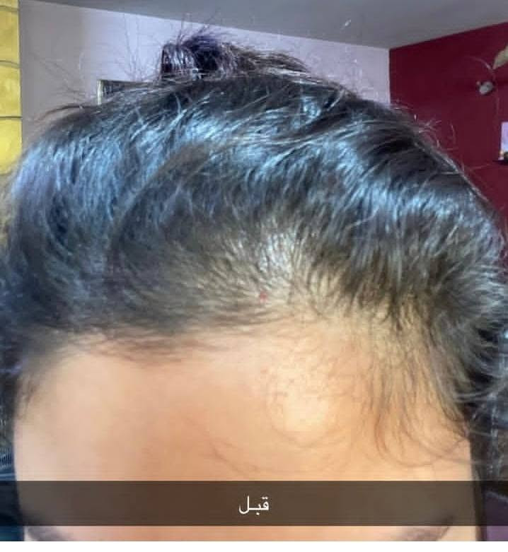أسرار الجمال المستوحاة من الطبيعة الغنية ✨💛. زيت الشعر والشامبو الطبيعي خالي من اي مواد كيميائية وحتلاحضون فرق من اول استخدام عن تجربة 
#الكل


**إذا كنت صاحب هذا الإعلان وتريد حذفه لأي سبب، رجاءا أرسل رسالة إلى الدعم الفني**