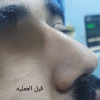 طبيب أنف وأذن وحنجرة • اختصاصي بورد • مجمع مدينتي