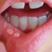 كربلاء الجمعيه • خلف مول الحارث • علاج مجاني