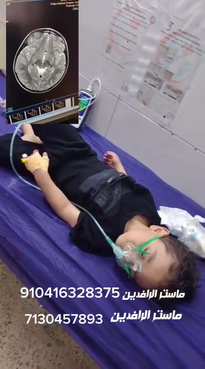 هذا حال الطفل عبدالله من كركوك حالته الصحية سيئة يحتاج تدخل جراحي في الدماغ يحتاج ٥ ملايين
رقم العائلة ***********
اذا متكدر توصلها اتصل على +***********
910416328375 ماستر الرافدين 
2150680862 ماستر الرافدين 
910416328375 ماستر الرافدين 
شارك المتشور 
#نبز_كركوكي
