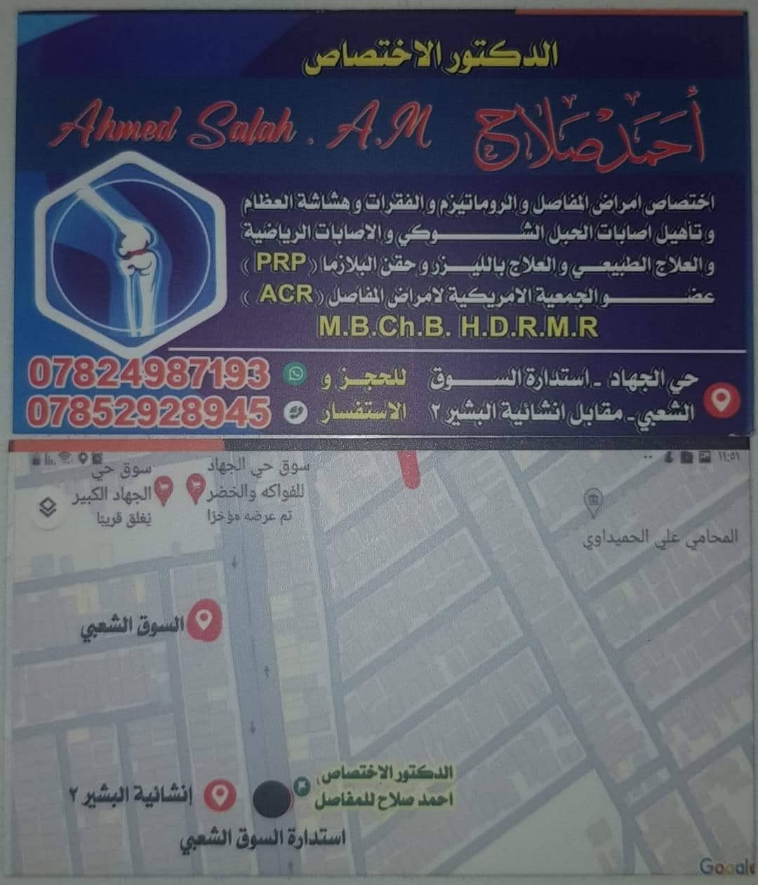 ١.علاج السوفان بحقن البلازما و الخلايا الجذعية و الابر الجلاتينية  بدلالة السونار
٢.علاج انزلاق الفقرات القطنية والعنقية بجهاز سحب الفقرات الكهربائي
٣.علاج نتوء الكعب بجهاز تفتيت التكلسات
٤. علاج المفاصل بالليزر البارد الحديث
٥. العلاج آلام المفاصل بالابر الصينية
٦. تأهيل اصابات الاعصاب و الكسور بأجهزة التحفيز الكهربائي و الحمام الشمعي
٧. فحص هشاشة العظام 
الدكتور الإختصاص احمد صلاح اختصاص أمراض المفاصل و الروماتيزم و التأهيل الطبي 
بغداد.حي الجهاد .استدارة السوق الشعبي مقابل إنشائية البشير ٢
للحجز والاستفسار 
***********
