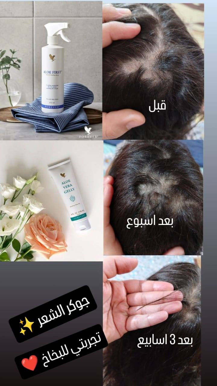 بخاخ الشعر   بديل زراعة الشعر  يعني بعد اليوم متحتاجون زراعة شعر لان البخاخ هاذ يملى الفراغات ويثخن الشعر بمدة اقل من 4 اسابيع تبدي فراغات الشعر نبت بصيلات شعر صغيرة و وبمرور الوقت تكدرون تلاحضون الفراغات بدت تنترس شعيرات صغيرة وهيج يثخن شعر ويطول 
الحل المثالي الجذري للشعر خصلنة من معانات شعري خفيف وشعري قصير وشعري يوكع ماكو بعد والتجارب كدامكم 👇🏻
و الله العظيم الفرق يبين من اول 3 اسابيع


**إذا كنت صاحب هذا الإعلان وتريد حذفه لأي سبب، رجاءا أرسل رسالة إلى الدعم الفني**