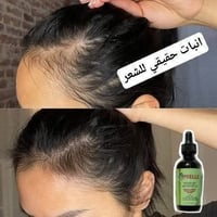 قطرات ميلي • تكثيف شعر • روزماري