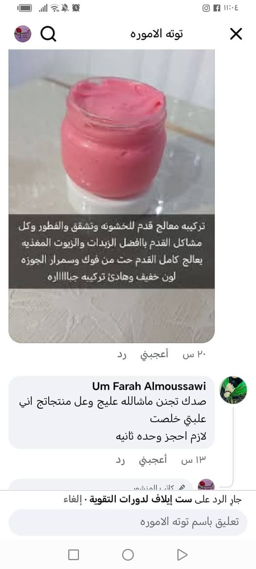لا تقصرون برفع الصفحه متعطله ❤️
بنات بس ب5 الف عافيه تخلين قدمج يضوي مرجوع فقط من أول استعمال يجنننن بالصيف اكيد تشققات وخشونه شرط مليان زيوت عشبيه وزبدات وكريمات مغذيه ترمم جلد من الداخل وتسوي القدم ناعممم وردي خفيف وحت من فوك ينطي تفتيح ويسوي الاضافر وردي عبالك بيبي حجم كبير يكفيج شهرين


**إذا كنت صاحب هذا الإعلان وتريد حذفه لأي سبب، رجاءا أرسل رسالة إلى الدعم الفني**