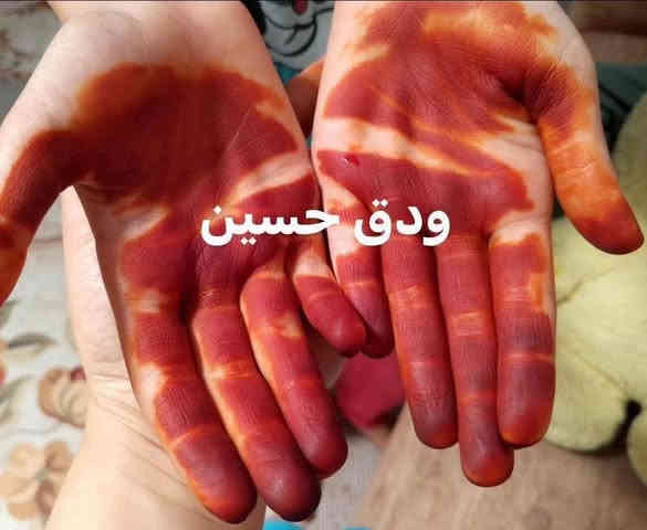 #توصيل_مجاني_الجميع_محافضات_العراق 
للحجز السريع على الرقم ***********

#الحنة_اليمنيه_الاصليه سعر الكيلو ٢٠
 #الحنه_العمانيه_درجه_اولى سعر الكيلو ٢٠ الف 
 من اجود أنواع الحنه ممتازه للشعر واليد والقدم 
خالية من اي اضافات 
تقوي الجذور وتمنع التساقط 
تعالج التقصف وطول الشعر خلال فترة قصيرة 
تنعيم ولمعان طبيعي للشعر
