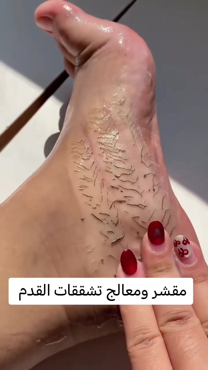 كل المنتجات متوفره عندي
الطلب والاستفسار التواصل بالخاص
توصيل لكل محافظات العراق

ادمن اول منشور


**إذا كنت صاحب هذا الإعلان وتريد حذفه لأي سبب، رجاءا أرسل رسالة إلى الدعم الفني**