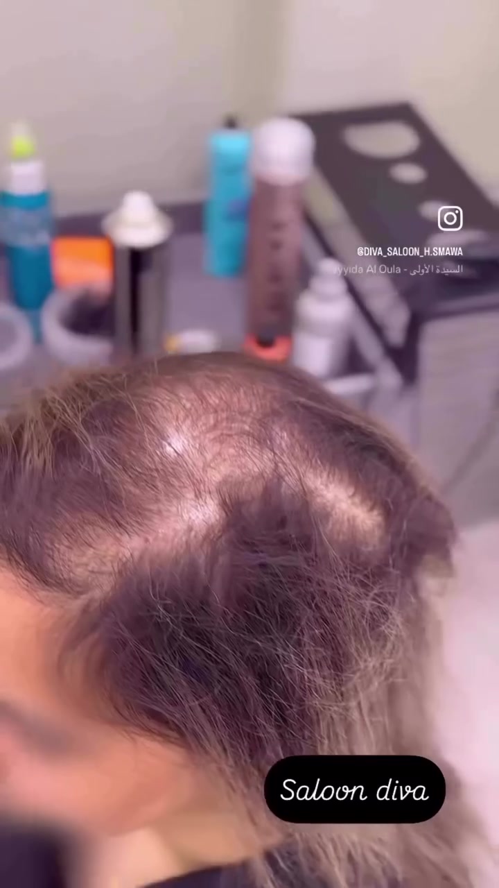 نبأ الشمري

صالون ديفا 🥰🥰

سماوه الغربي مقابل متنزه الورده 

***********

https://www.instagram.com/diva_saloon_h.smawa?igsh=dTEyYm1xc2lianJ0
