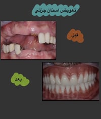 📍عيادات ابن سينا التخصصية-مقابل محطة وقود البياع 📝للحجز والاستفسار: .م...