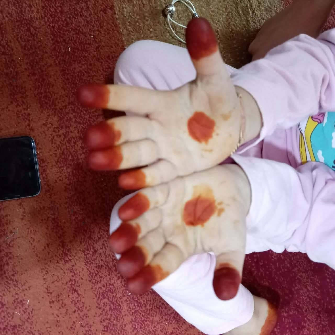 السلام عليكم بنات توفرت الحنة السعودية الأصلية سعر الكيس ألف ونص لتريد تراسلني خاص
@إشارة


**إذا كنت صاحب هذا الإعلان وتريد حذفه لأي سبب، رجاءا أرسل رسالة إلى الدعم الفني**