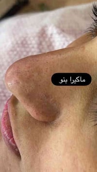 صالون بنات • تنظيف بشرة • المعهد التقني