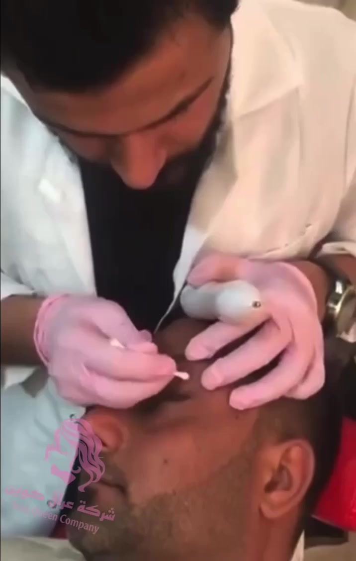 من شركة انزو الاصلية 💯💯
جهاز ازالة الشام والزوائد اللحمية والفالول فعال ومضمون 🌺
جهاز ازالة الشامات والحبوب والزوائد  ( الفالول) 💯 ✔️ 
تستطيعين من خلاله ازالة الشامات غير المرغوبة ✔️
ازالة الزوائد نهائيا ✔️
ازالة الفالول وعدم عودته ✔️ ✔

جهاز عملي جدا وسهل الاستعمال يعمل عالشحن ويجب شحنه قبل استعماله 👍

السعر 🔥🔥و التوصيل مجاني 
🚘 يوجد خدمة توصيل لجميع محافظات العراق 🚘


**إذا كنت صاحب هذا الإعلان وتريد حذفه لأي سبب، رجاءا أرسل رسالة إلى الدعم الفني**