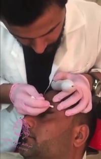 انزو الاصلية • ازالة الشامات • الناصرية