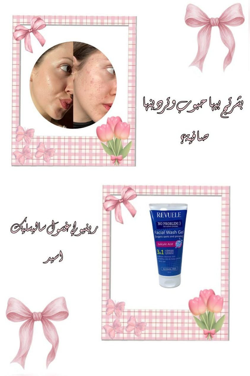 #عناية_بالبشرة #روتين_العناية #منتجات_عناية #نضارة_طبيعية #عناية_يومية #منتجات_مضمونة #جمالك_طبيعي #اكسبلور #سكن_كير
#اكسبلور_العراق_السعوديه_الاردن_ايران_الكويت_طق_لايكات_كومنت_يلاا_فولو_بغداد_ميوزكلي_العراق_لبنان_الامارات_البحرين
#اكسبلور_مواد_طبية_وتجميلية_أصلية
#اكسبلور_مشاهير_أكراد_عرب_سوريا_العراق_كوردستان_المانيا_ #اكسبلور_مشاهير_أكراد_عرب_سوريا_العراق_كوردستان_المانيا_
#اكسسورات_شنط_ساعات_كبك_باقات_ورد_طقوم_رجاليه_ونسائيه_استشور_فير_تغليف_هدايا_هدايا_حفلات


**إذا كنت صاحب هذا الإعلان وتريد حذفه لأي سبب، رجاءا أرسل رسالة إلى الدعم الفني**