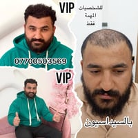 لا مجال للمنافسة!🔥 نحن نصنع معجزات ✍️  مركزنا لزراعة الشعر  ليس فقط مر...