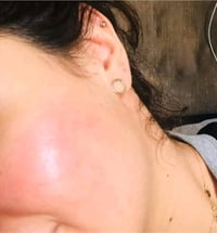 خلطة وجه • بدون كيماويات • تنفخ الوجه