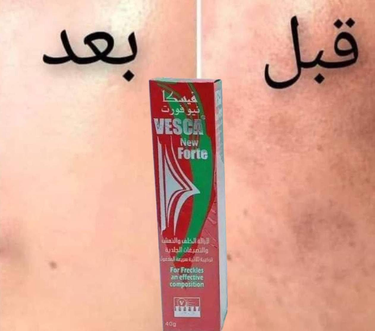 ❣️⁩‌❣️⁩#كريم_فيسكا_نيوفورت‌ مع الصابونة ❣️⁩‌❣️⁩
الاصلي 💙

🟢🔴🟢 كريم فيسكا نيوفورت للكلف والنمش والتصبغات الجلدية وتبيض :

🔴كريم مركب من مجموعة من المواد الطبيعية الفعالة لتنقية البشرة 

🔴كريم فيسكا نيوفورت  لإزالة الكلف والنمش والتصبغات الجلدية 

🔴تركيبة ثلاثية سريعة المفعول 

🔴يمتاز بإزالة الكلف الناتج عن تعرض البشرة لأشعة الشمس 

🔴يعمل على ترميم البشرة وترطيبها لاحتواءه على زيوت طبيعية  

🔴يعيد للبشرة حيويتها ونضارتها لتصبح أكثر نعومة 

🔴يحتوي على خلاصات نباتية تمتاز بفعاليتها بالقضاء على المستعمرات الجرثومية 

🔴يمتاز بإزالة المفرزات الدهنية وتقشير الطبقة الجلدية

سعر الكريم مع 
الصابونة 18 الاف 
🚘 يوجد خدمة توصيل لجميع محافظات العراق ٤ الاف 🚘 رقية مصطفئ @


**إذا كنت صاحب هذا الإعلان وتريد حذفه لأي سبب، رجاءا أرسل رسالة إلى الدعم الفني**