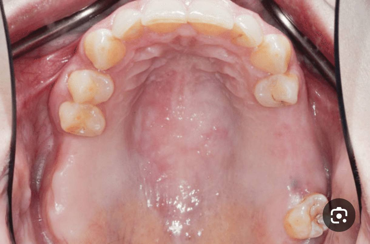 تعويض الاسنان مجانا
الي عنده فقد باسنانه مثل هاي الحالات يكتبلي أو يتواصل وياي 
***********
