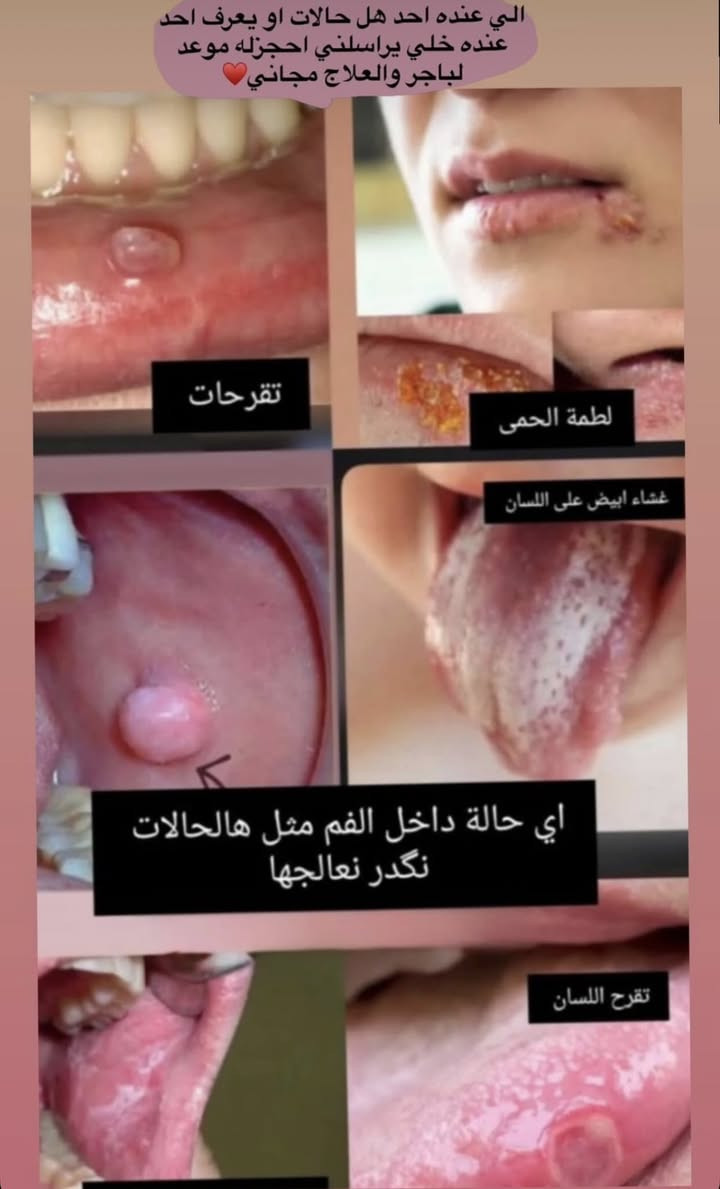 العلاج مجاني ***********
