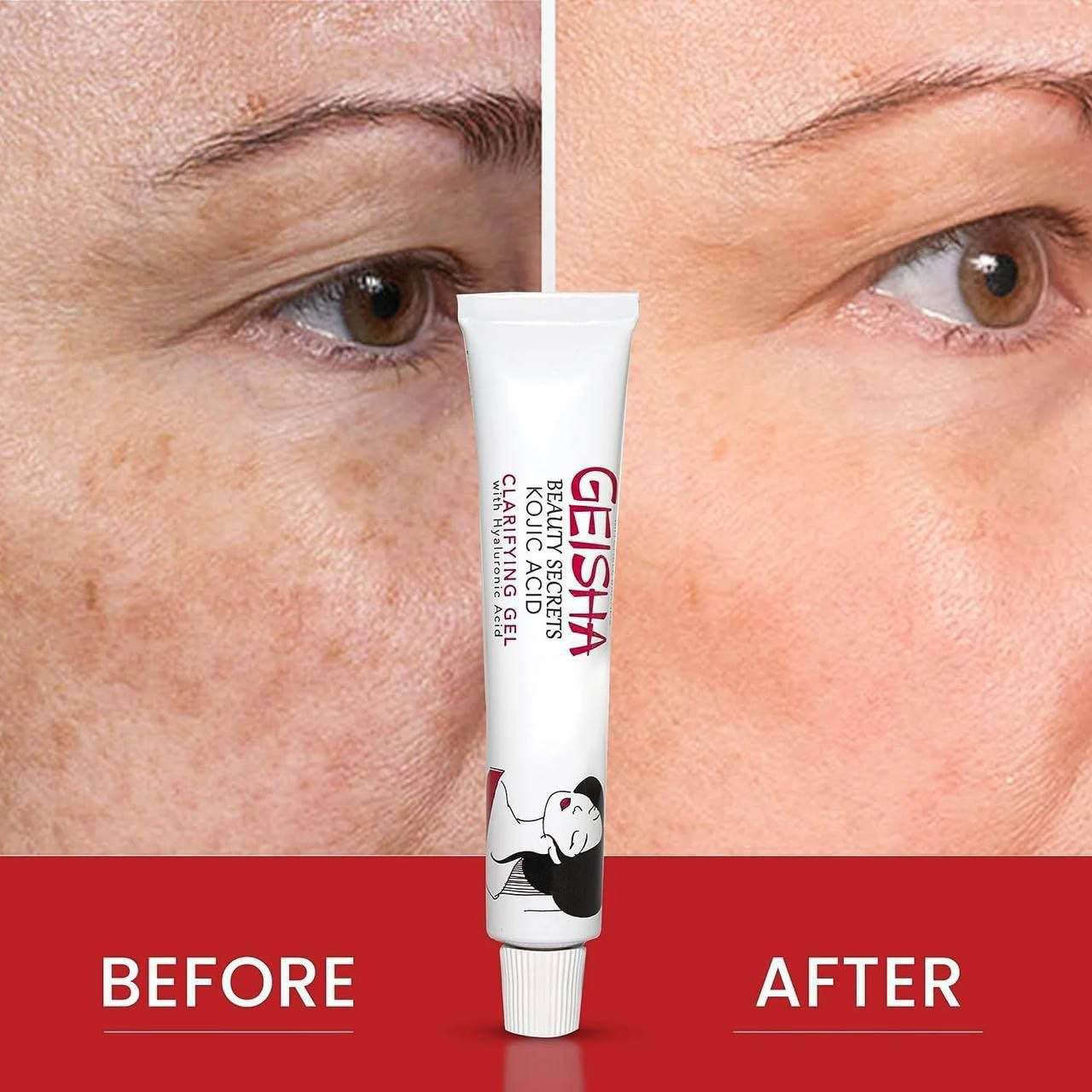 ✨ عصارة غيشا من كوجي ✨
GEISHA BEAUTY SECRETS KOJIC ACID BRIGHTENING 
CREAM
🌟 كريم غيشا العالمي 🌟
🔑 سر من أسرار الجمال بـ حمض الكوجيك 🔑
💖 فوائد المنتج:
 ⚡ أقوى كريم لتفتيح البشرة: يحتوي على حمض الكوجيك المعروف بقدرته العالية على تقليل التصبغات والبقع الداكنة.
 🎯 توحيد لون البشرة: يساعد في تحسين مظهر البشرة غير المتجانسة ومنحها مظهراً متناغماً.
 ☀️ مكافحة الكلف والنمش: يقلل من ظهور الكلف والنمش الناتج عن أشعة الشمس أو التغيرات الهرمونية.
المنشأ لبنان الأصلية 🇱🇧 بغداد, العراق


**إذا كنت صاحب هذا الإعلان وتريد حذفه لأي سبب، رجاءا أرسل رسالة إلى الدعم الفني**