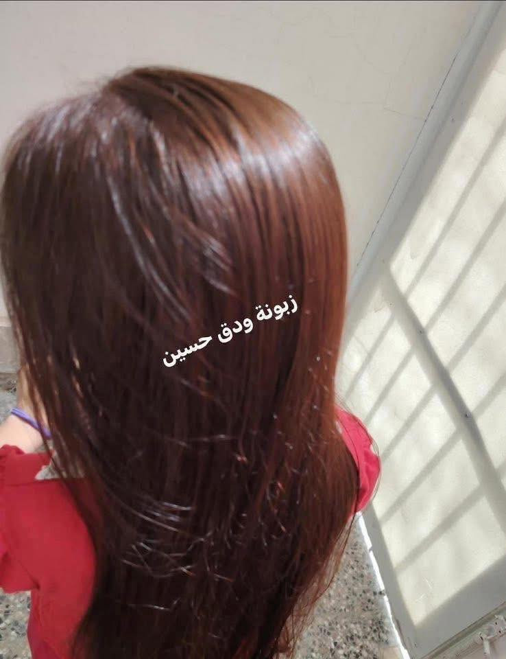 تدرون هذا الجمال كله المن ؟🤔 
هذا جمال #الحنه اليمنية 😍
اليمنية وبس والباقي خس 😂


**إذا كنت صاحب هذا الإعلان وتريد حذفه لأي سبب، رجاءا أرسل رسالة إلى الدعم الفني**