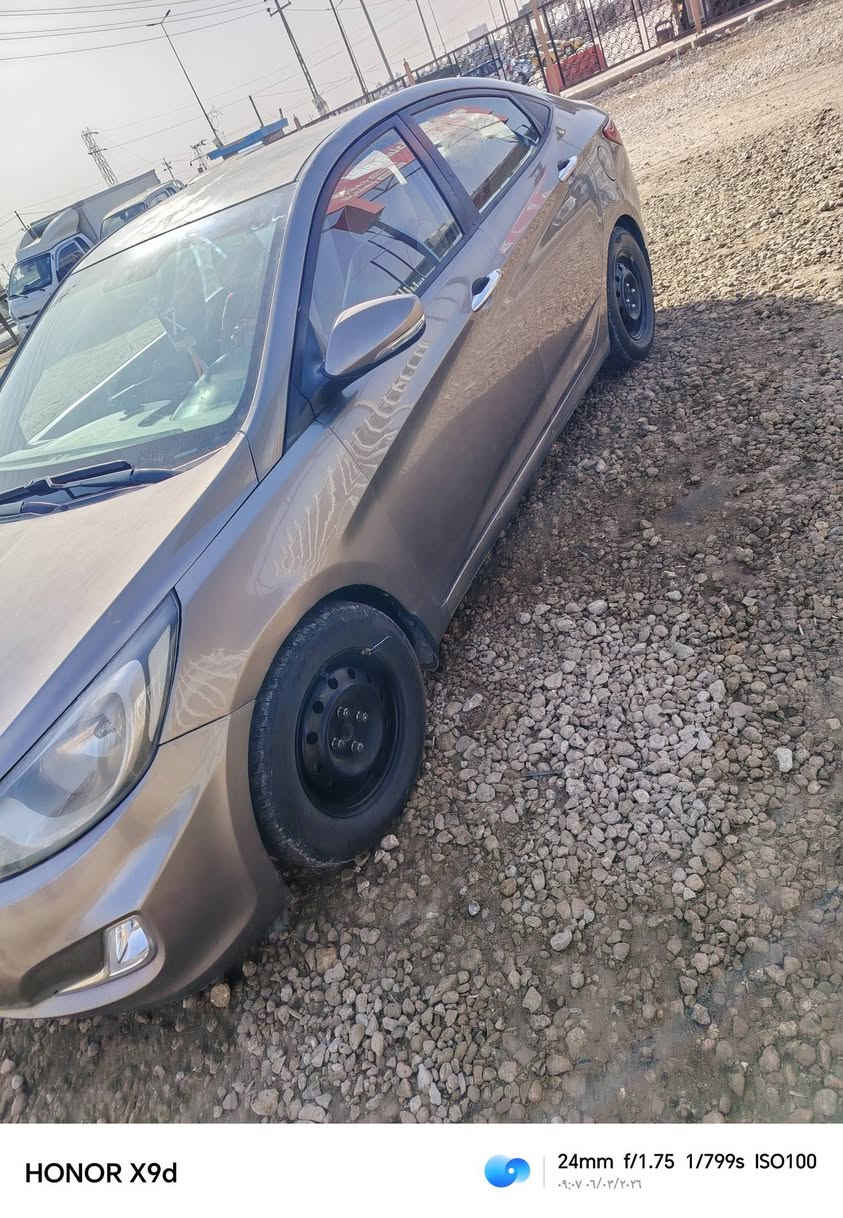 السلام عليكم
اكسنت مديل 2014 مكينه 1600
صبغ احزام بيه أثر جراد
مكينه كير نضيفات لاتنقيص ولا تبخير
حداديه جديده تخم تاير هم جديد
مكان السياره القادسيه
السعر 85 وبيه مجال قليل
رقم موبايل
***********
