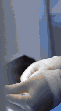 الدكتور نذير وائل العاني Dr. Natheer Wael Alani

الدكتور 
نذير وائل العاني 
دكتورا(بورد عربي-عراقي)جراحة الكلى والمسالك البوليه
رفع البروستات وتكسير الحصى بالناظور والليزر 
جراحة الاورام السرطانيه للكلى والمثانه والبروستات 
معالجة السلس البولي لدى النساء 
والتشوهات الولادية عند الاطفال 
اختصاص دقيق في العقم وعلاج الضعف الجنسي لدى الرجال 
عضو الجمعية الاوربيه لجراحة الكلى والمسالك البولية
M.B.CH.B F.I.B.M.S(URO) C.A.B.S(URO)
***********
