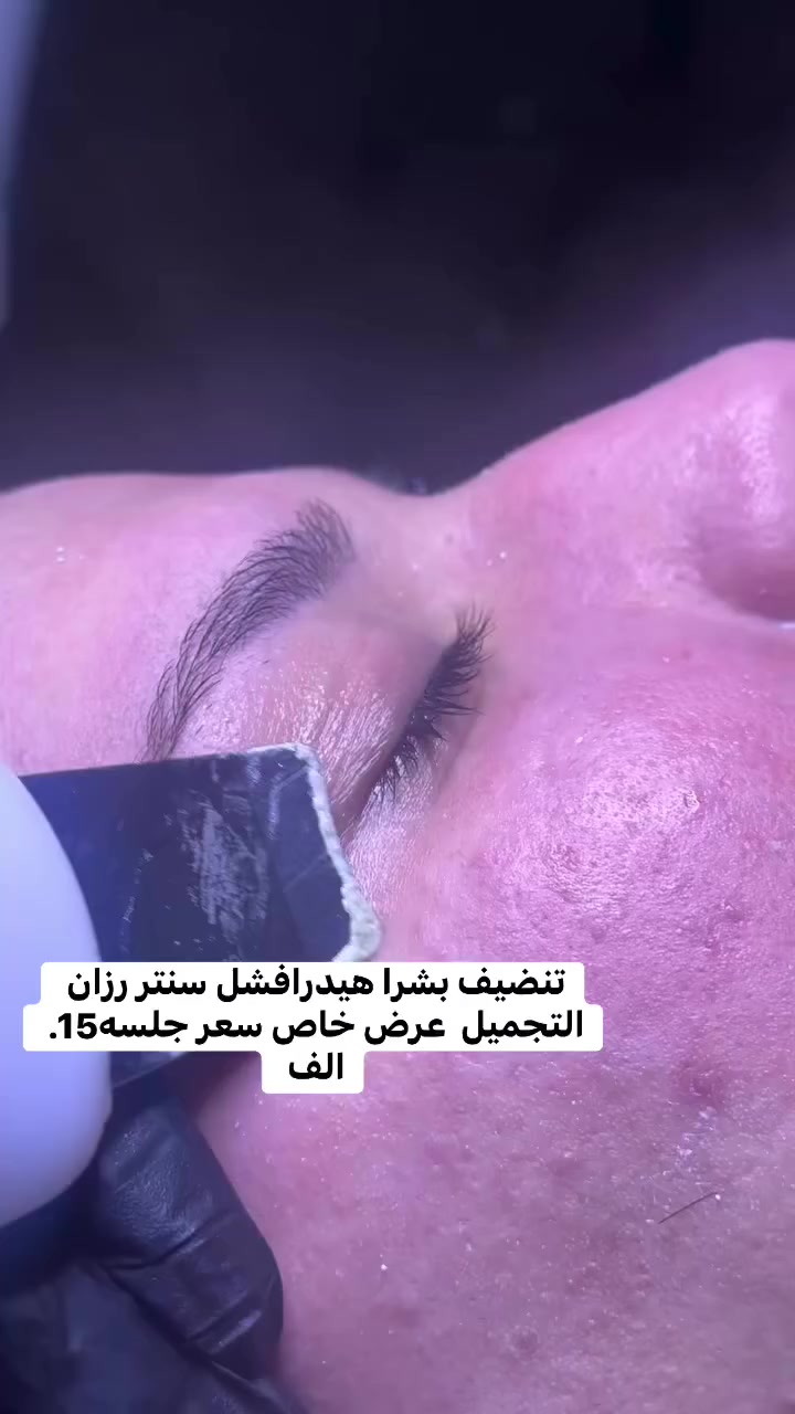 العنوان جسر ديالى القديم شارع60 قرب معهد الزهراء النموذجي او جامع رسول سنتر رزان التجميل رقم الواتساب ***********
