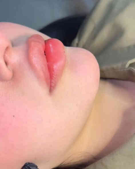 نوعان من جمال المرأة: واحد ينطقك وواحد يفقدك النطق
الجمال كله موجود يمنة الاختيار منج والشغل علينة
مركز اوتار كلنك لطب الأسنان والتجميل 
العنوان الشموخ خلف مكتب الحنين للعقار داخل الفرع 
للحجز الاتصال على الرقم 
***********
                 https://www.instagram.com/p/DP_hUuQjKPC/?igsh=aTZwbW1nMmFoNW11
