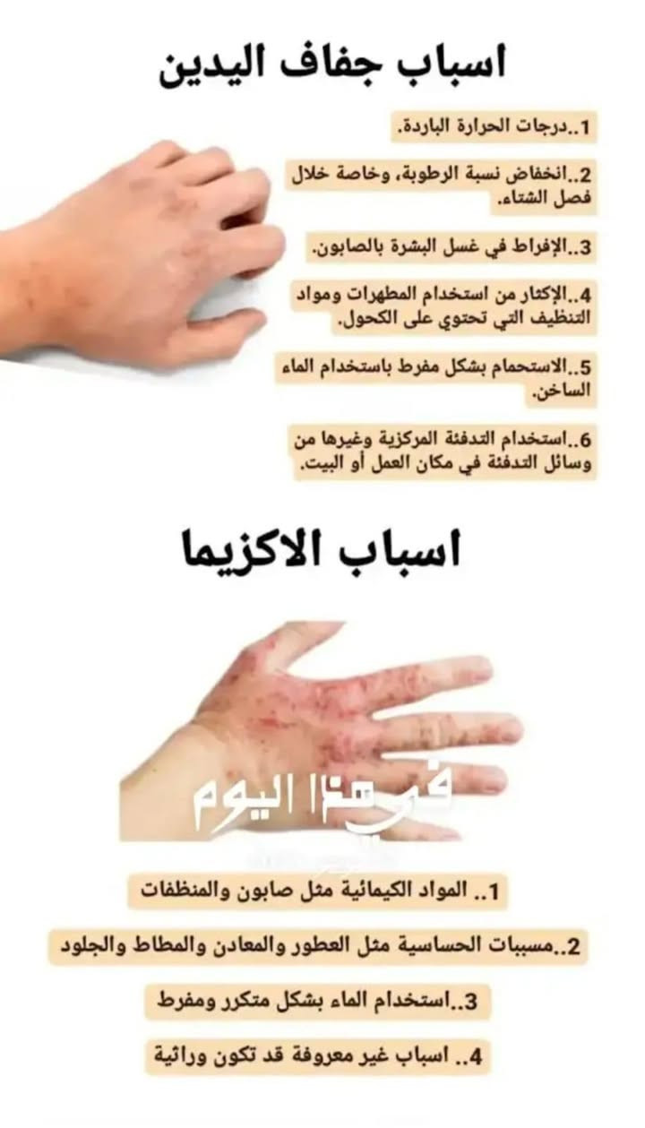 ✨منتجات والعلاج طبيعي شركة ليدورا العالميه✔️✨
♦مع الضمان لكل المنتجات والعلاج الطبيعي♦

منتجات عناية من شركة ليدورا العالميه 
منتج شعر يتكون من 5قطع علاج مضمون
💯💯
علاج كلف نمش تصبقات 
علاج تعرق الجسم 
علاج تشققات لاقدام 
علاج خشونه اليد 
علاج الجسم من جلد الوزه 
علاج براند طبيعي 
حصرن يتوفر بس يمنه 😍
من شركه عالميه عشبيه

1_للتجميل+العناية_للجسم وشعر الوجه كافة ✨

2_كل الحالات يشوفهة اخصائي او مستشار خاص للجلد وبشرة والشعر والجسم 

3_اعطاء علاج المناسب لكل حالة نستطيع علاجها- ولاكن العلاج يكون للمشاكل الخارجية فقط وليس المشاكل الداخليه 🔴

4_يتم متابعة الزبون ع مدار 4اسابيع او اكثر حتي يتم العلاج النهائي لحالة الشخص 

5_كل سبوع يوجد نادي للعملاء الي مسوقين من عدنة سابقا_واذا عدهم اي سؤال او استفسار يخص حالة معينة عدهم او اشخاص اخرين عادي جدا🔴
لذالك كل سبوع يوجد مستشار بشرة وشعر التشخيص مجانا يكون لديهم✅
 

🔴لدينا مستشارين ومستشارات خاصين للنساء والرجال🔴
    🔺يوجد توصيل لكل مناطق الكوت
#مكانه واسط_الكوت//#رقم_الهاتف: ***********
