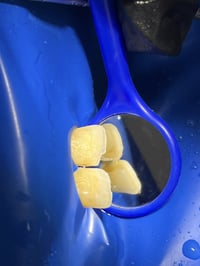 شغل اسنان • حجز مجاني • شارع الحولي