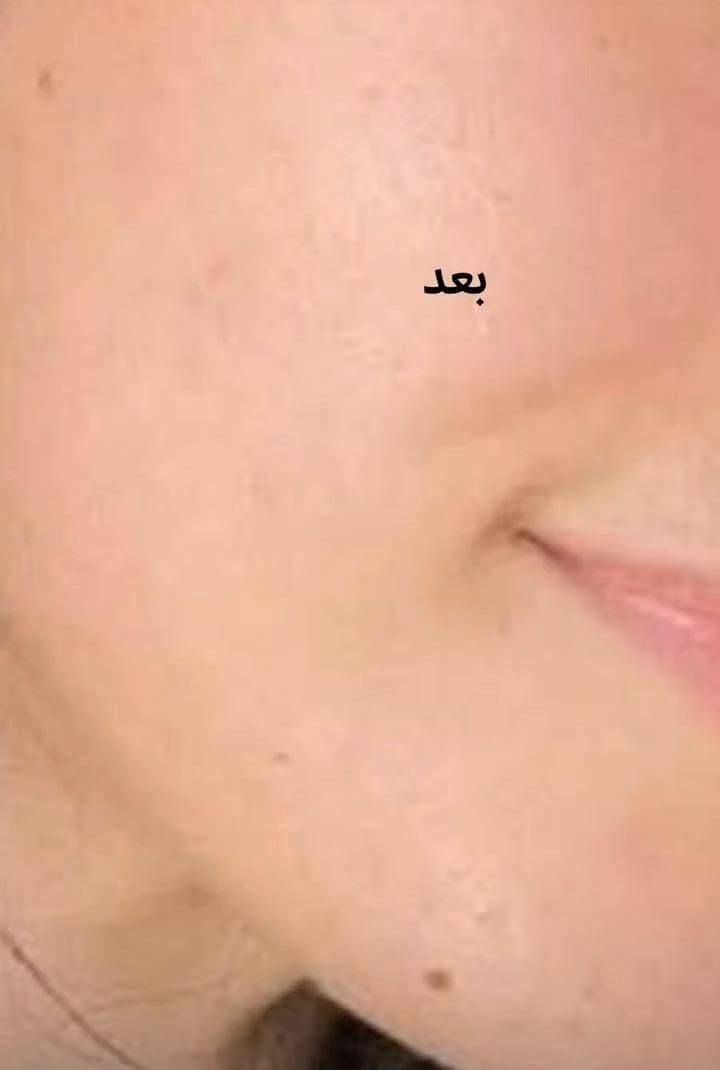 هلو بنات جبتلكم بكج كامل سيروم وكريم وصابونه للوجه اذا مو  من اول اسبوع شوفين فرق ترجعيه موجود توصيل بغداد ومحافظات وبسمايه


**إذا كنت صاحب هذا الإعلان وتريد حذفه لأي سبب، رجاءا أرسل رسالة إلى الدعم الفني**