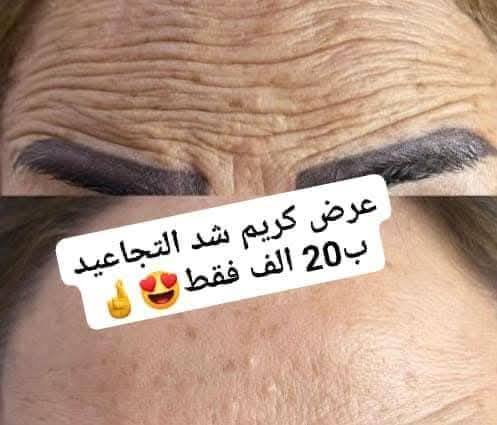 عرض ب 20  الف فقط
معالج تجاعيددد😍🤞

عرض جديد وحصري
كمية محدودة 😍🤞

والله لتجربة متخسر🤞😍


**إذا كنت صاحب هذا الإعلان وتريد حذفه لأي سبب، رجاءا أرسل رسالة إلى الدعم الفني**
