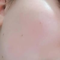 خلطة للوجه • تبييض وكلف • ضمان ١٠ أيام