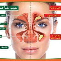 الجيوب الأنفية • الزوائد اللحمية • كوت واسط