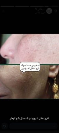 بكج رمان • يخفي التجاعيد • تبيض البشرة